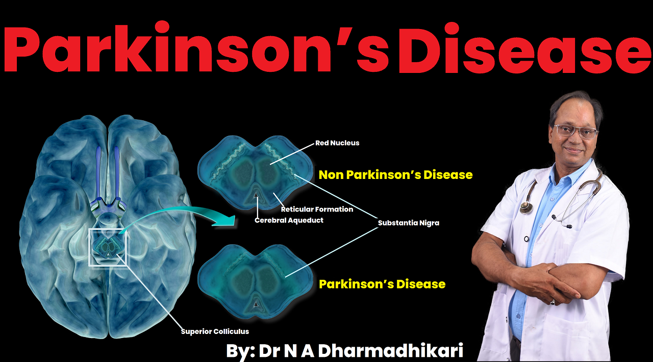What Is Parkinson's Disease ?