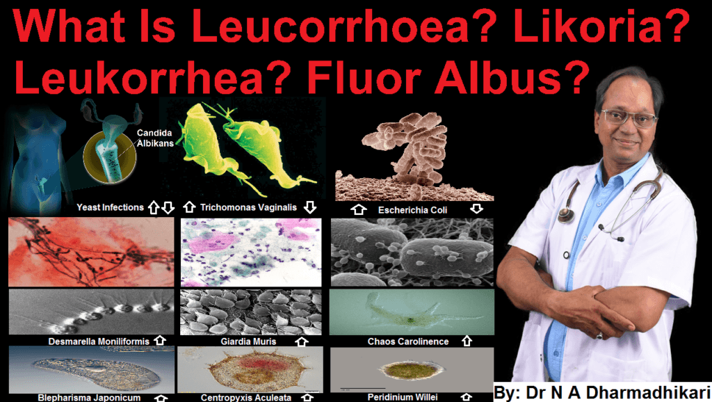 Leucorrhoea Awareness – Dr. Dharmadhikari’s Clinical Guide सफेद पानी (लिकोरिया) के बारे में जानकारी – डॉ. धर्माधिकारी की चिकित्सीय मार्गदर्शिका