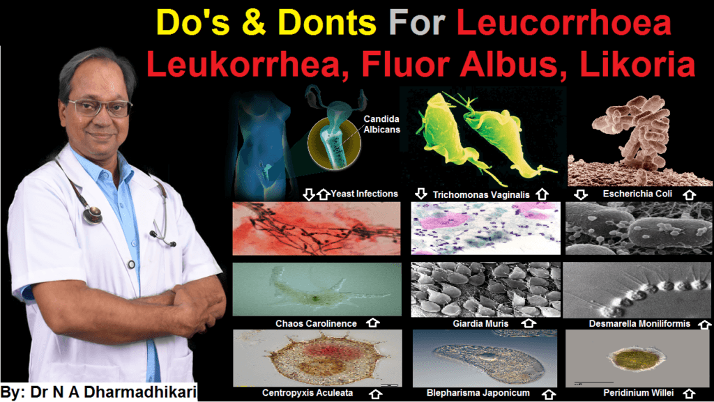 Do’s and Don’ts for Leucorrhoea – Women’s Intimate Health लिकोरिया के लिए क्या करें और क्या न करें – महिलाओं के स्वास्थ्य के लिए