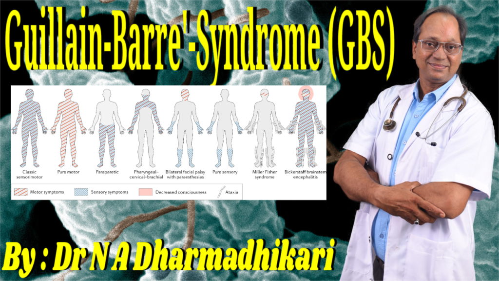 Guillain-Barré Syndrome (GBS) clinical types with motor and sensory symptoms infographic, explained by Dr. N. A. Dharmadhikari in his health pillar blog.