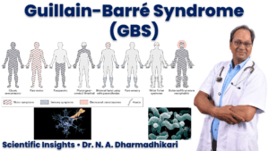 guillain barre syndrome gbs clinical patterns nerve damage campylobacter jejuni scientific insights dr n a dharmadhikari Guillain–Barré syndrome (GBS) scientific illustration showing eight clinical patterns, nerve damage, Campylobacter jejuni, and Dr. N. A. Dharmadhikari
